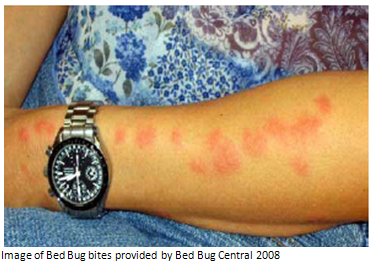 bed bug bites vs flea bites